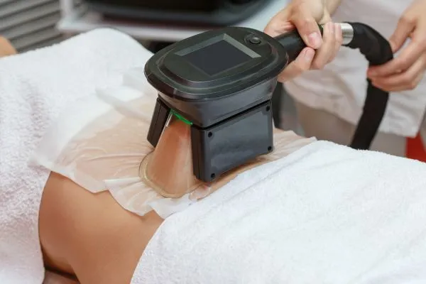 Image of person having fat freezing treatment to help weight gain Braintree
