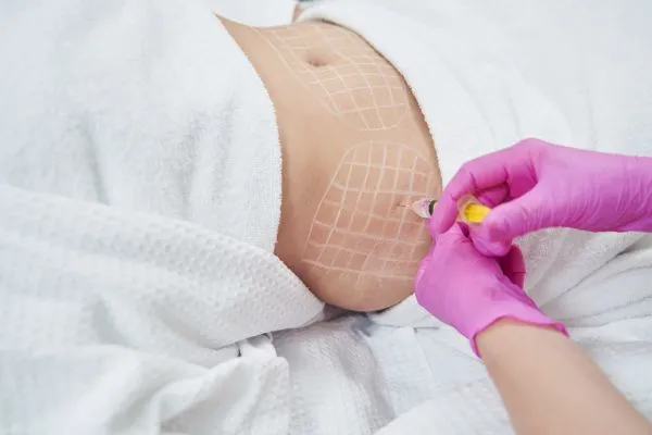 image of fat dissolving injections on love handles to help combat weight gain Braintree