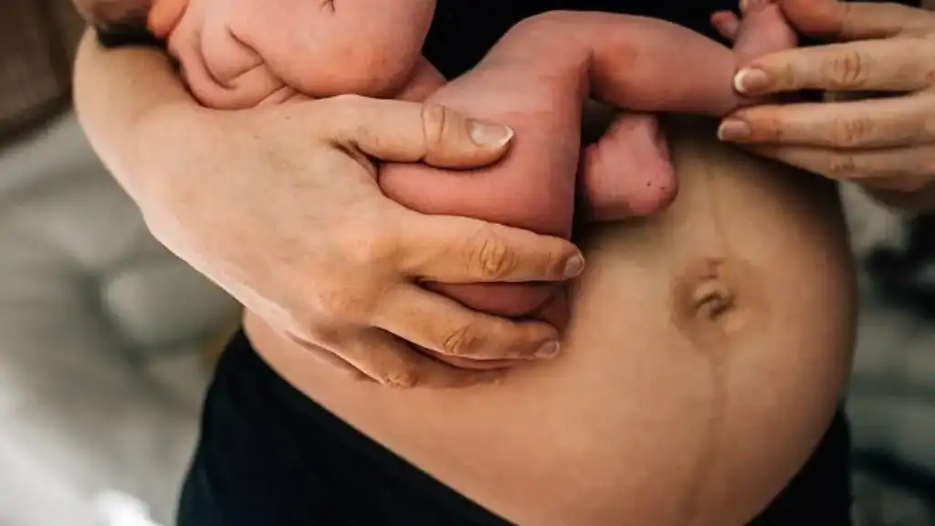 Why Is My Stomach Still Big After Pregnancy Braintree?